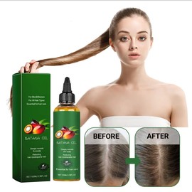 Oil for Hair Growth, Anti Hair Loss Treatment, 3.38 FL OZ, For Men & Women, All Hair Types batana treatmnt