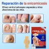 Culdsnia Parches Para Uñas Fúngicos De Parches 42 Pcs /