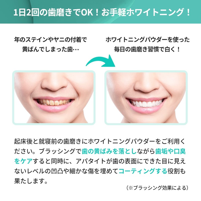 Whitening 1.8 oz (50 g), Large Capacity, Teeth Whitening Specialty