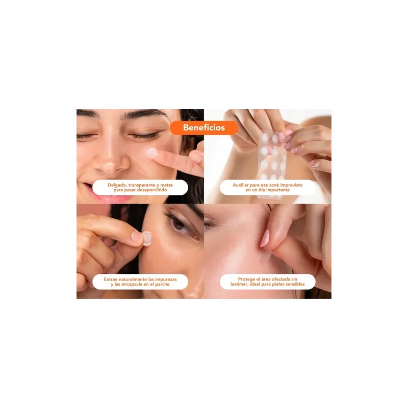 Alux Skin Parches Hidrocoloide Para Acné 30 Piezas Todo Tipo