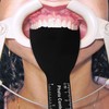 6 uds contraste Dental intraoral fotográfico Dental negro tablero de