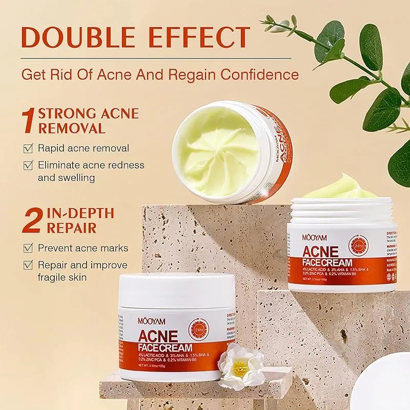 Crema De Tratamiento Del Acné For Espinillas, Puntos Blanc I