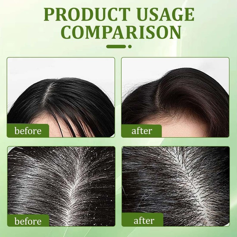 YOFDAL 2 Pezzi Shampoo solido bio Anticaduta, Shampoo Crescita Capelli