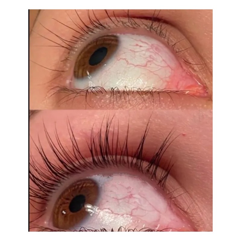 Versox Excelente Serun Para Crecimiento De Pestañas Y Cejas