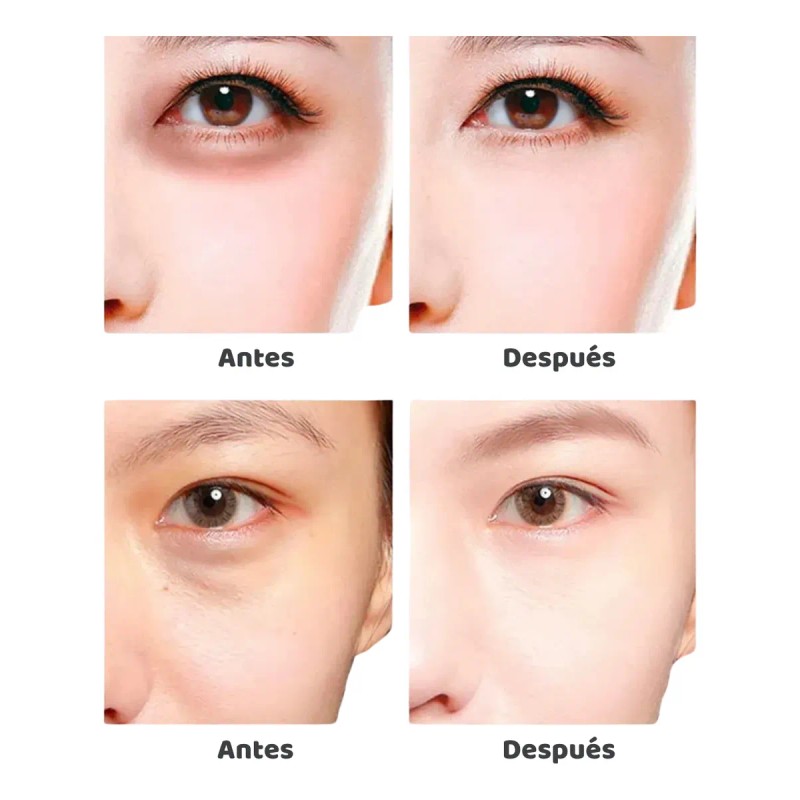 Acido Hialuronico B5 + Parches Ojos Ácido Hialurónico Full