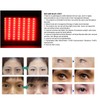 Red Blue Light Therapy Acne Removal Beauty Instrument Photon Skin