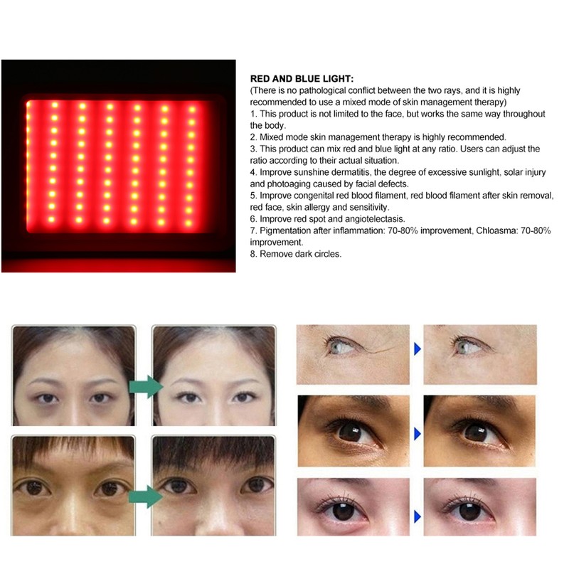 Red Blue Light Therapy Acne Removal Beauty Instrument Photon Skin