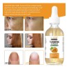Suero Cúrcuma Facial Corporal Antiedad Manchas Hidratación
