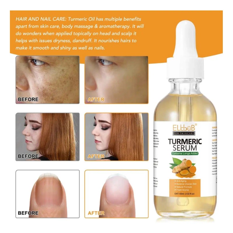 Suero Cúrcuma Facial Corporal Antiedad Manchas Hidratación