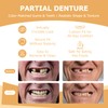Partial Dentures - Dentures for Missing Teeth & Gaps -