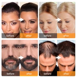 Root Touch Up Instantly Gray Hair Coverage and Hairline Powder, Conceal Hair Loss and Thinning For Women and Men, Hair Fibers (Light Brown)