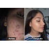 Crema Facial Artesanal Piel Bonita