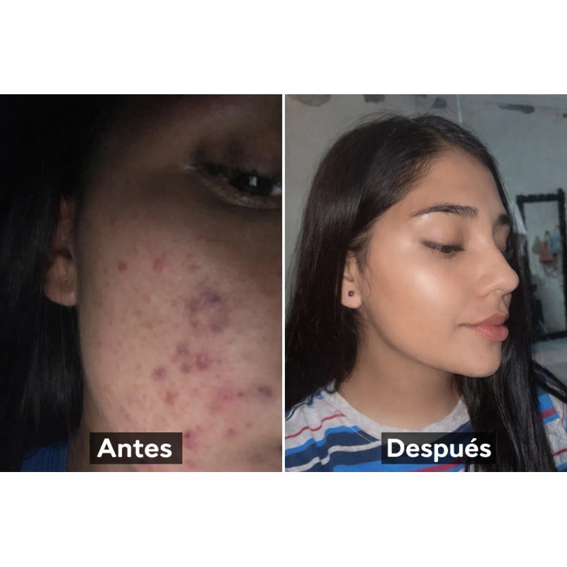 Crema Facial Artesanal Piel Bonita