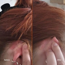 STRAAND The Crown Fix Prebiotic Scalp Care Soothing and Protective Serum 15ml