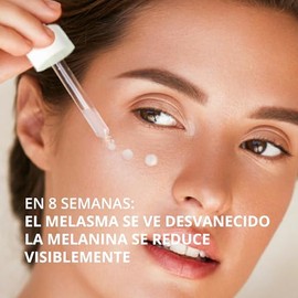 Abera Melasma Sérum, Suero Facial Despigmentante, Tratamiento para Melasma y Manchas Oscuras, con Niacinamida, Genowhite y Baba de Caracol, Hidratació