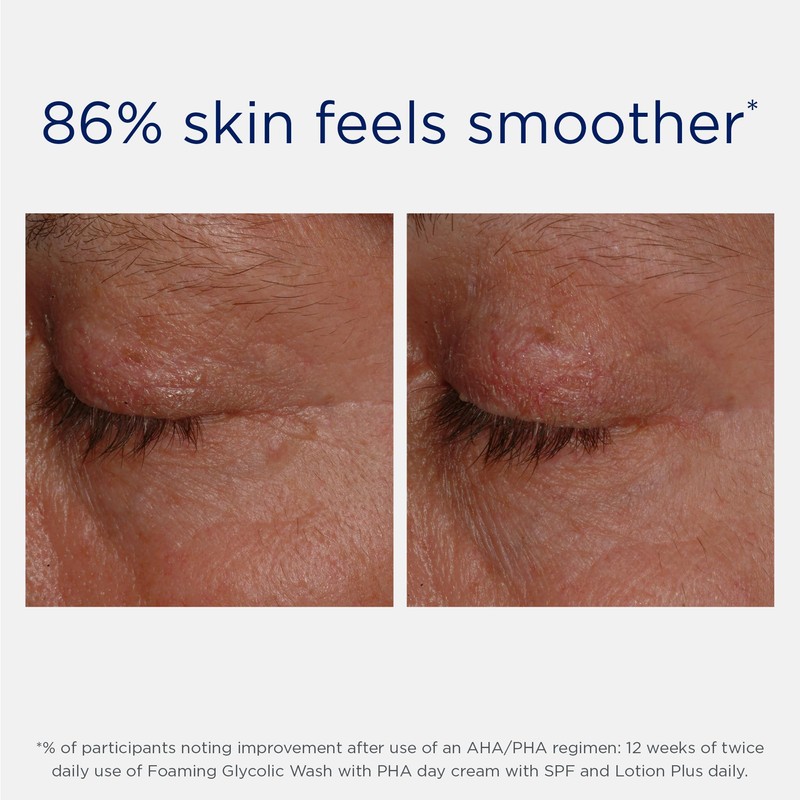 NEOSTRATA Foaming Glycolic Face Wash High Strength AHA Cleanser Soap-free,