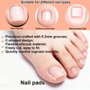 106pcs Ingrown Toenail Corrector Kit, Toenail Correction Strips Tape Ingrown