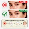 Lusabe Parches Para Acn Invisibles 36pzs Pimple Patch
