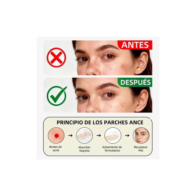 Lusabe Parches Para Acn Invisibles 36pzs Pimple Patch