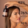 Apivita Shampoo Contra las Caspas Secas 250ML