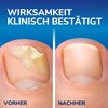 Scholl 2-in-1 Pen for Nail Fungus