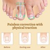 TYBYBB Ingrown Toenails Set, Nail Clip, Toenail Correction, Ingrown Toenail