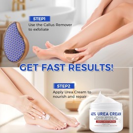 OUKEYA OUKEYA Urea Cream 40 Percent for Foot & Hand Cream with Foot Files for Dry Cracked, 40 per Urea Lotion for Feet Maximum Strength