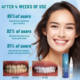 3 Pcs Mullein Gum Repair Gel, Mullend Teeth Repair Gel, Gum Shield Therapy, Revitalizes Gums and Instant Teeth Whitening Serum Pen, Natural Protect Gums & Oral Care, Fresh Breath