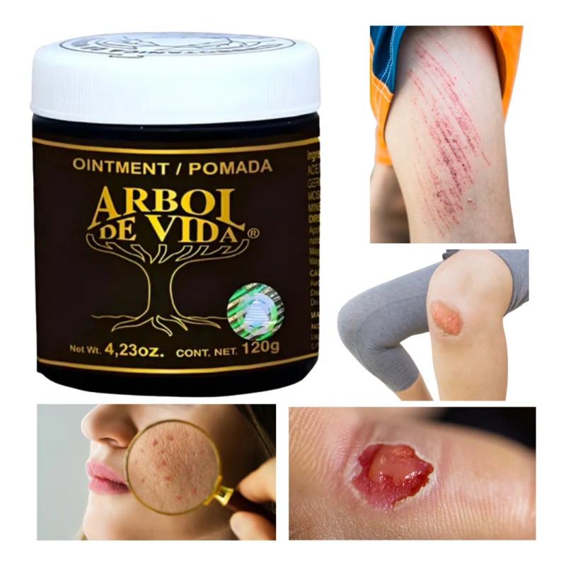 Pomada Árbol Vida Tepezcohuite Arbol