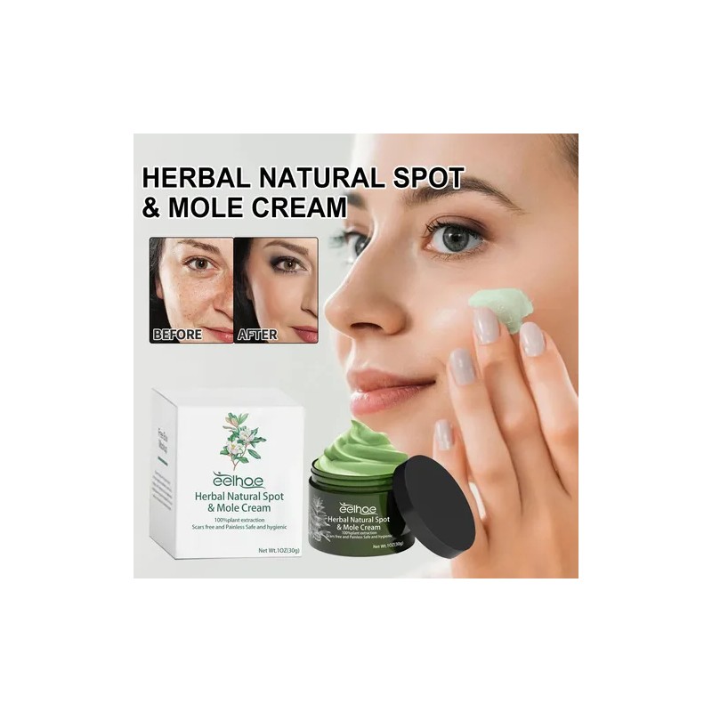 Whitening Cream Cream Against White Stains Antifreckle White