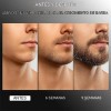 Gel Espesante Para Barba Cuidado Suave