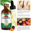 Batana Oil Organic,Batana Oil For Skin Moisturizer And Dry Skin