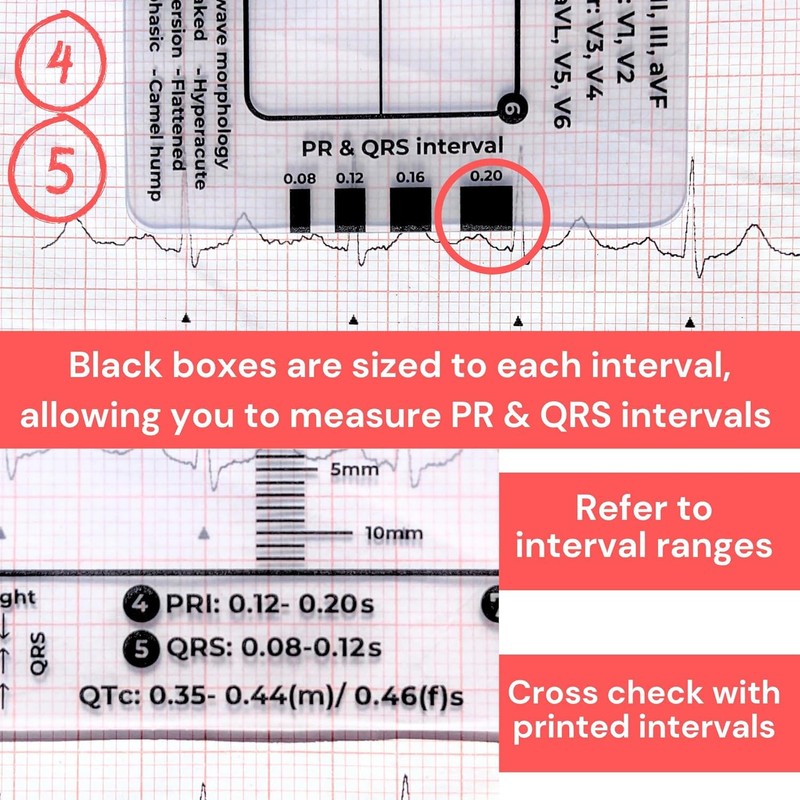 Yeanifeana ECG 7 regla de pasos, ECG 7 regla de