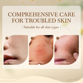 ARCHIDATE Tallow and Honey Balm Stick, Beef Tallow Moisturizing Stick for Dry Rough Skin, Enriched Vitamin E Olive Oil, Fast Absorption, Soft Smooth Skin, Reduce Fine Lines and Wrinkles