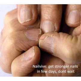 NAILVIVE Nail Serum Powerful Magic-like Silk Proteins Proven Natural Formula Strengthening Hardening nails Instantly Prevents Splits Chips Peels Cracks on Your Nails (BOTTLE APPLICATOR)
