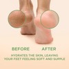 Lee Beauty Professional Callus Remover for Feet - Tea Tree,