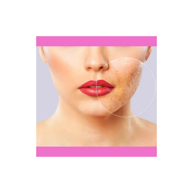 Crema Facial Concha Nacar + Jabón Leche De Burra, Aclarante