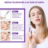 4 Piezas Crema Ácido Azelaico 15% Suero Facial,Sérum para el