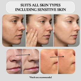 Vivo Per Lei Facial Peeling Gel - Helps Address Dead Skin Buildup - Gentle Exfoliating Gel for Rough, Dry, Sensitive or Mature Skin - Face and Body Scrub - Non Abrasive - 4.05 Fl. Oz.