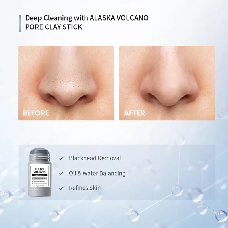 2 Uds Aceite De Control Profundo, Barra De Mascarilla De