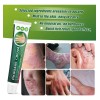 Maquillaje Para La Psoriasis Según Lo Descrito\ R\nreutiliza