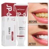 MS.Dear 2PCS Super Probiotic SP-6 Toothpaste, Probiotics Bright White Toothpaste,