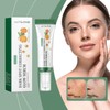 Spots Removal Serum, Niacinamide Serum for Face, Dark Spot Correcting
