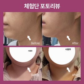 The Medi Doctor Double chin guasha massage / Shrink cream 120ml, 1 piece / 이중턱 괄사마사지 / 슈링크림 120ml, 1개