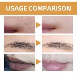 Facial Hair Removal Cream For Women,Depilatory Cream For Smooth Face Body Skin,Gentle And Soothing Hair Removal,Lip Hair Removal Cream,Suitable For Delicate Facial Areas,Suitable For All Skin Types