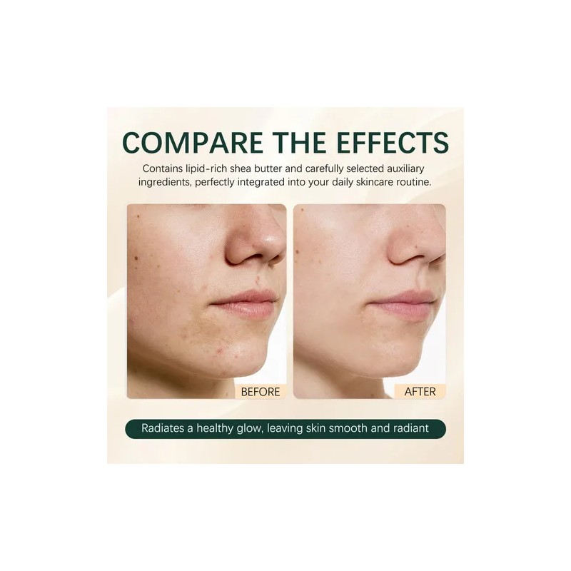 Glow Serum Repara Piel Sensible Para Mujeres Y Hombres