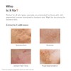 Minimalist 32% AHA PHA BHA Peeling Solution for Glowing Skin,