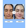 Serum Despigmentante Quita Manchas Con Vitamina C