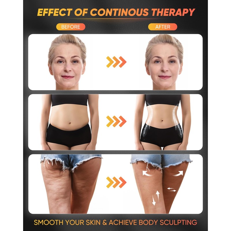 ONUEMP 4-in-1 Stainless Steel Massage Therapy Tools for Ice Body