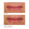 NASSIF MD Exfoliante Labial Nassifmd De Vainilla Y Azúcar, Hidratante